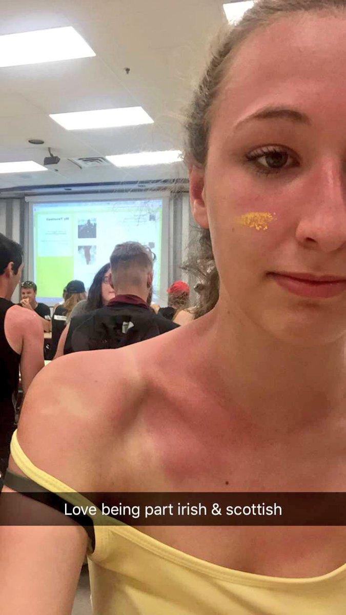 dana_lawless11's tweet image. I used so much sunscreen yet the sun still destroyed me #RelayForLife #lancersagainstcancer