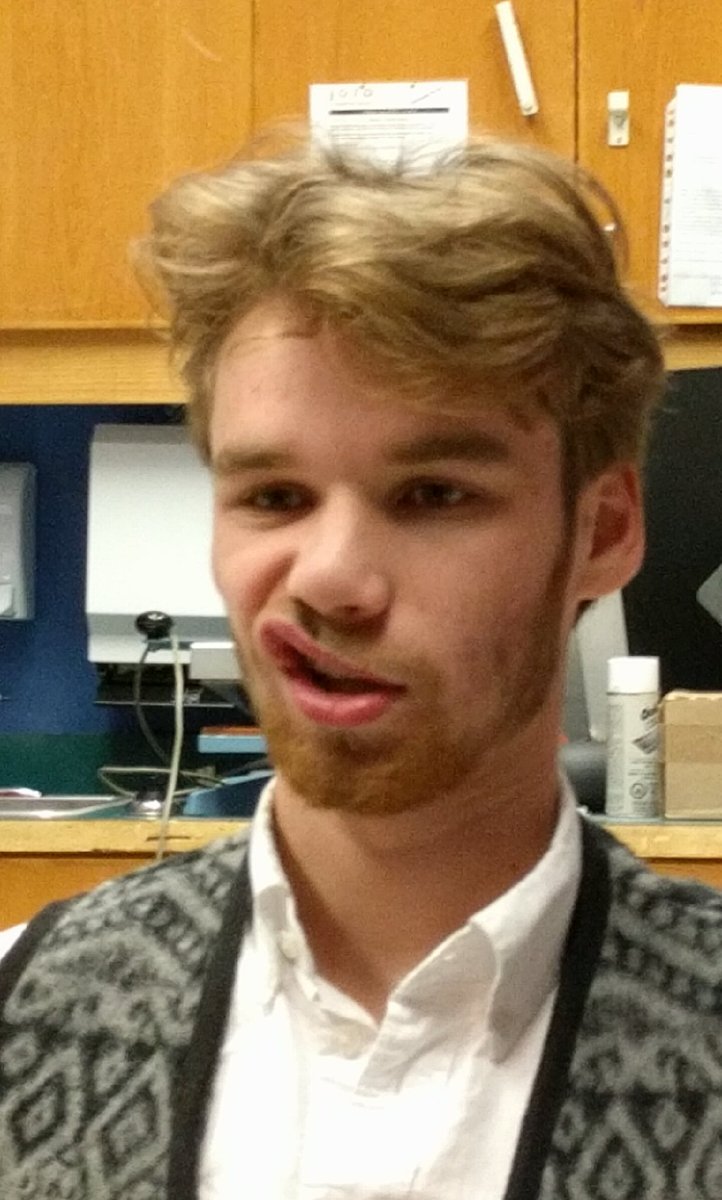 Jacoblab1's tweet image. #lancersagainstcancer