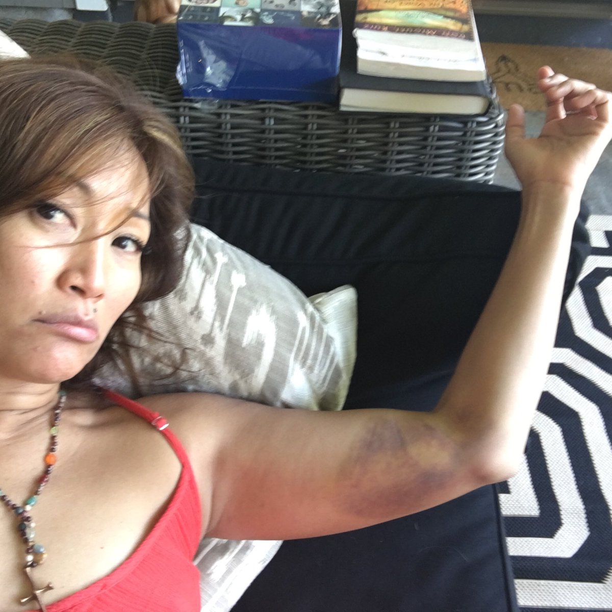 carrieanninaba's tweet photo. I guess I am not #katnisseverdeen #archeryfail #didntusethearmguard #shouldHaveUsedTheArmGuard ๐ https://t.co/PzUrlvaF5d