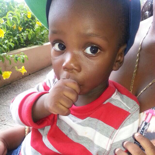 Pinkbackprogram's tweet image. After&amp;amp; Before donate at PinkBackProgram.com to help . Brain Tumour 21 month old baby boy in Antigua .Thanks