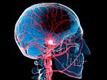 Primal_Digest's tweet photo. @JunoBiomedical Stroke patients to walk, talk and live a #NormalLife after...
https://t.co/4G05Dpjp2Y via dailymail https://t.co/JHwoTVefRu