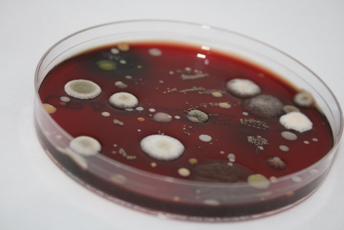 Fascinating> RT @BBCRadio4: Gut feeling. How bacteria can change your state of mind: https://t.co/M0sITbNmBi<a class="tags" target="_blank" title="On Twitter" href="/?out=eyJ0eXAiOiJKV1QiLCJhbGciOiJIUzUxMiJ9.eyJpYXQiOjE3MjUxMTY4NjgsImlzcyI6InR3cG9ybnN0YXJzLmNvbSIsIm5iZiI6MTcyNTExNjg2OCwiZXhwIjoxNzU2NjUyODY4LCJyZWRpcmVjdF91cmwiOiJodHRwczovL3R3aXR0ZXIuY29tL0JCQ1JhZGlvNCJ9.6dzkccKdaaF6G85mKe2OUOAjfd78StgabNAYlGed2bXZbrq-QQbDNAYk96GY_tmTSxCN9E2ZNiXbZP1psMaVzg">@BBCRadio4</a><a href="/tag/r4in4"class="tags"><span>#r4in4</span></a>
