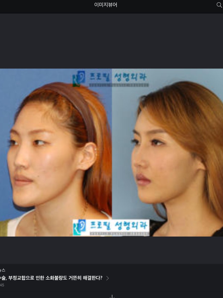 本田 剛 中国で最近使われているフレーズ 日本人女性は化粧で変わる 韓国人女性は手術で変わる 中国人女性はアプリで変わる T Co Tcsmrfmfq9 本田 剛 中国で最近使われているフレーズ 日本人女性は化粧で変わる 韓国人女性は手術で変わる 中国人女性はアプリで変わる T Co Tcsmrfmfq9