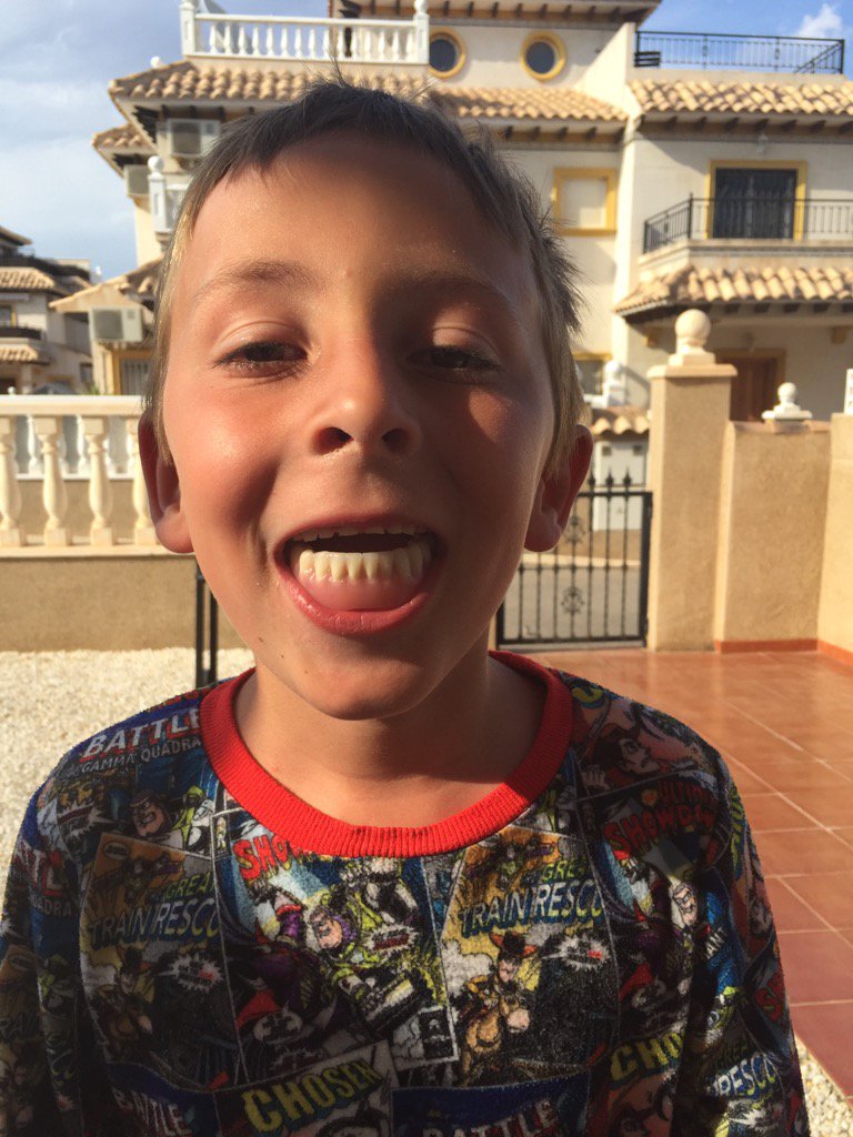 do not let your child find someone's fails teeth on the beach and be allowed to play with them #hugghh