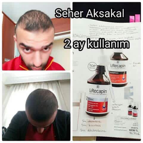 ilknurbzgl's tweet photo. #Lr 'ın en beğeni alanı #recapin kellik ilacı degildir. #sackıran için çözümdür ve kökleri besleyerek kelliği önler. https://t.co/DK3fC6y0hF