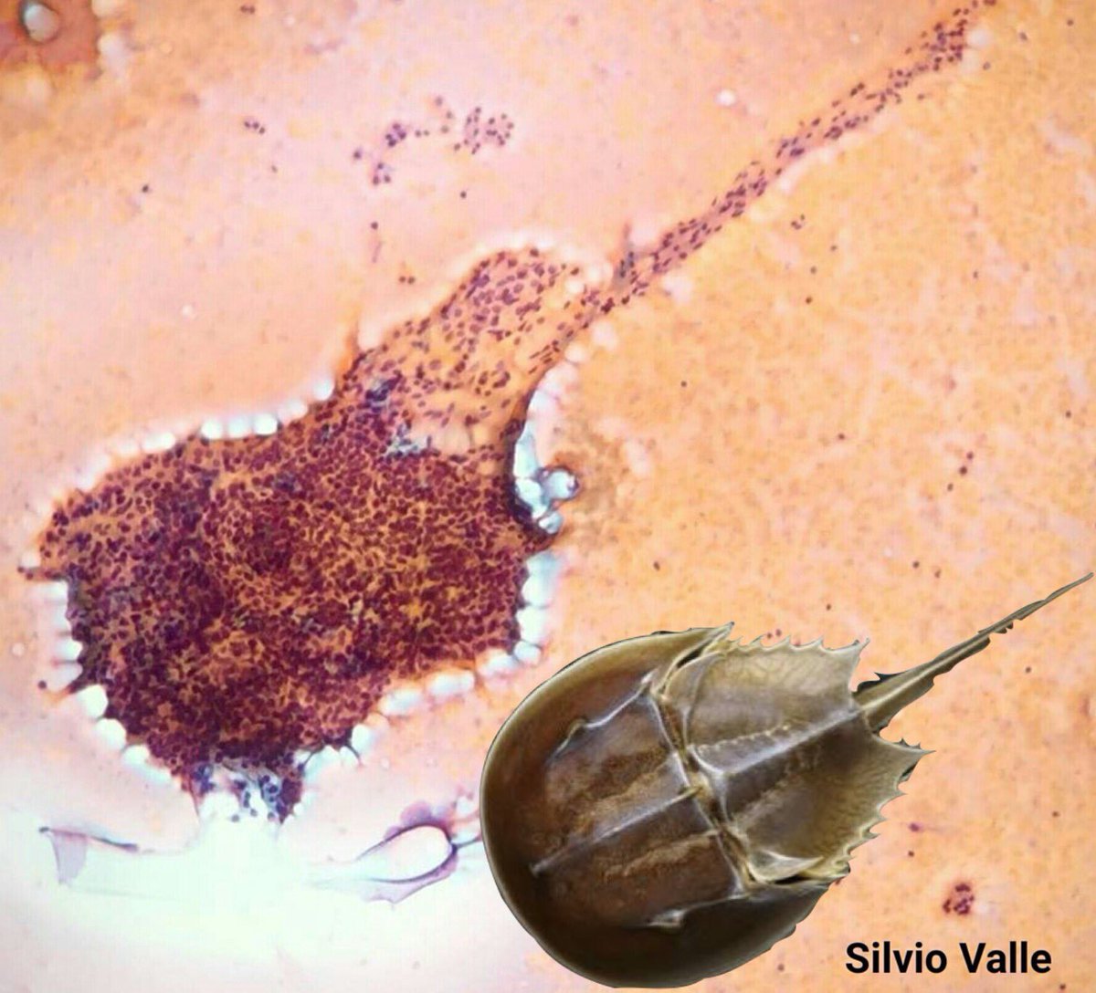 Chapman_Histo's tweet photo. @GeronimoJrLapac @smlungpathguy The biologist in me saw something a bit different.... https://t.co/YrIZVnXy6A