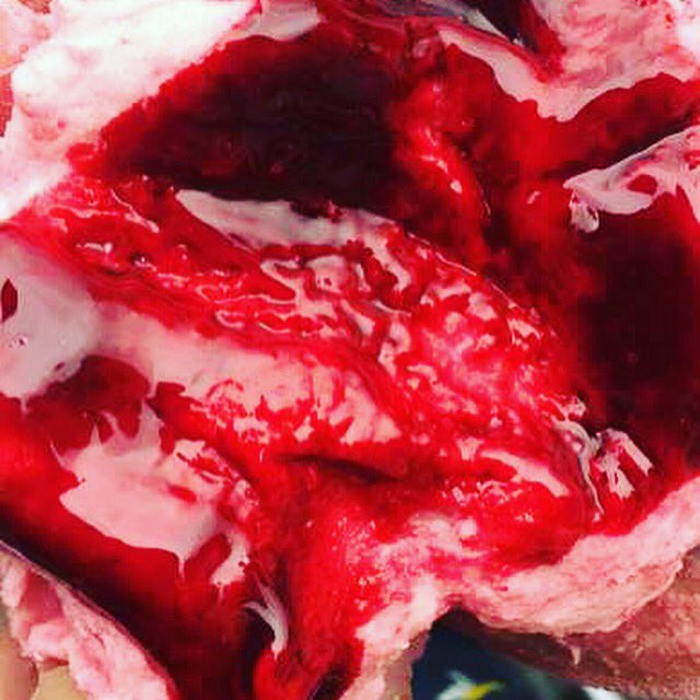 Snapflashgroup's tweet photo. Found this crazy photo on Snapflash App! #uni #unwetter #uni #student #iosapp #blood https://t.co/C5DuRTyg5G