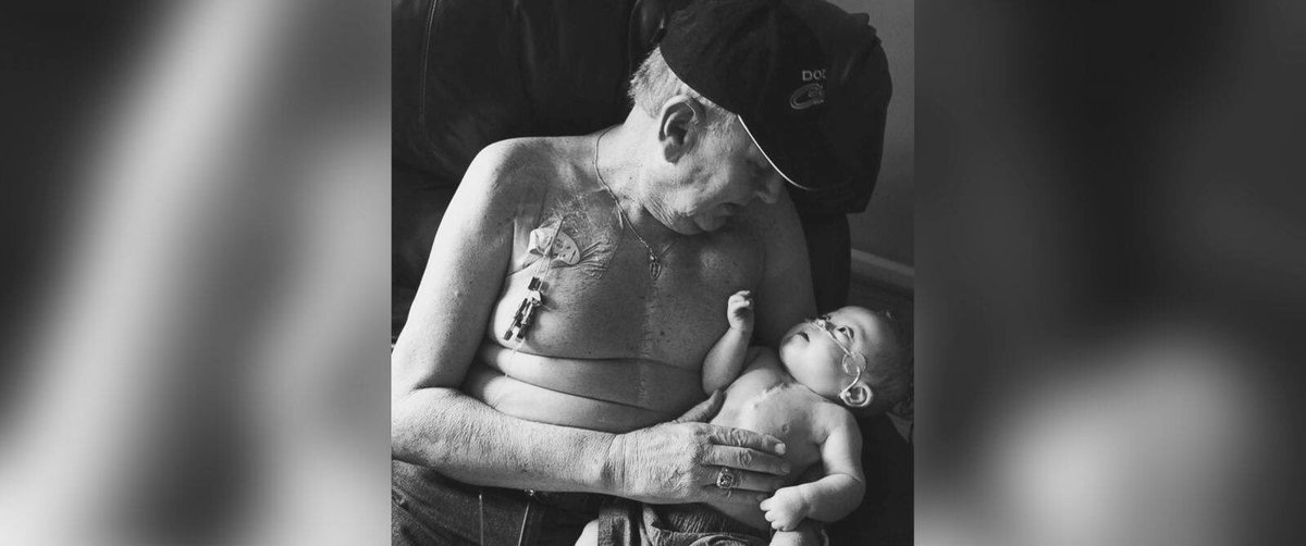 This photo circling the web has certainly caught our eye! Grandfather &amp; grandson with matching #ZipperScars #Love