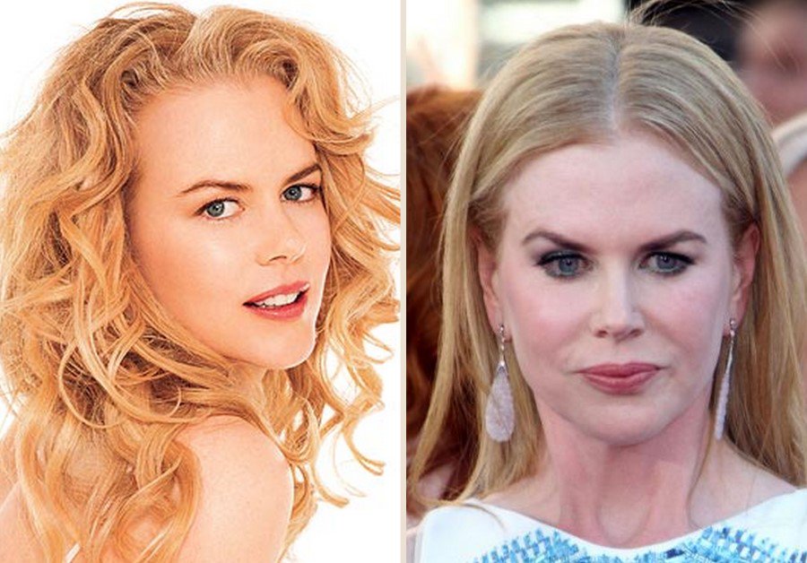 edition_daily's tweet photo. Celebrity Plastic Surgery - Shocking Before And After Pictures! -  https://t.co/DQM6GjJGZW https://t.co/665XwRidYe