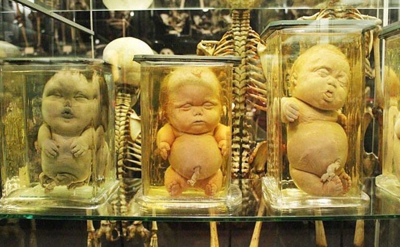アート Twitter પર フロリク博物館の標本 奇形の人体を収蔵している博物館としては世界的に見ても最大規模の施設になります
