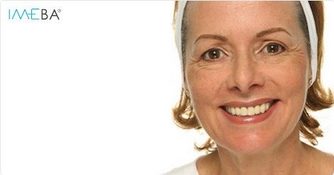 IMEBAInfo's tweet image. Haga click aquí para verme antes del tratamiento: tinyurl.com/h9mpfoj  #mallorca #Palma #belleza #estetica