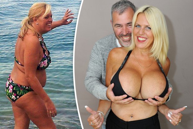 Britain's biggest boobs? Glamour model gran splashes divorce cash on 32MM  breast implants - Mirror Online