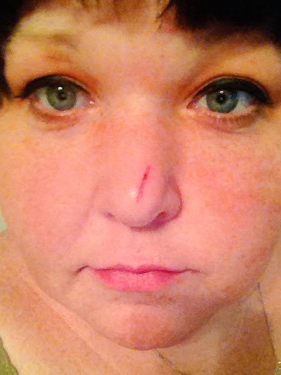 justredjess's tweet photo. Mean 'ol kitty strikes again!! #nosebiter #chompcat https://t.co/LogdlR4EEk