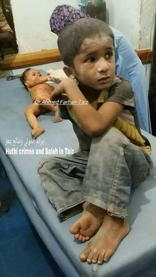 FIRASATYEMEN1's tweet photo. #Houthi crimes in #Taiz #Yemen continues.. https://t.co/MLxrWyPqHr