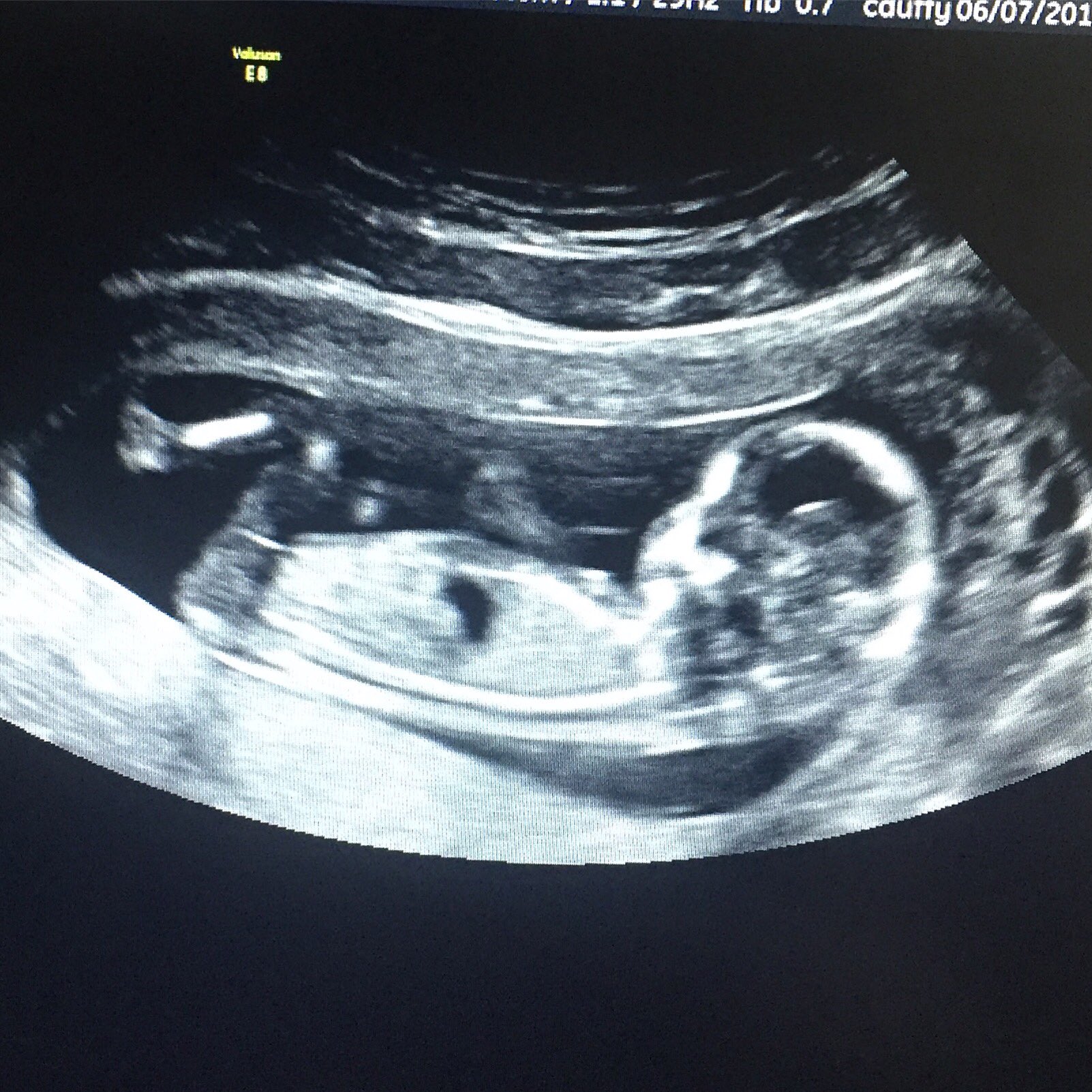 My child is everything to me ❤️ https://t.co/FBsT25ciJZ