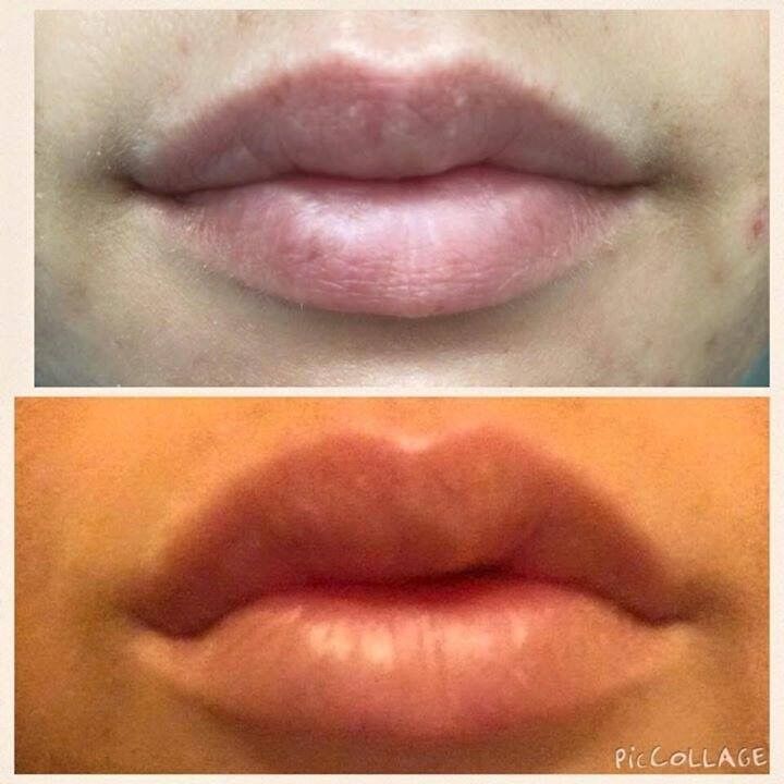 SteffBirch's tweet photo. Check out these amazing results... #Contouring/PlumpingLipGloss #DefinedCupidsBow #FullerLip #AmazingResults https://t.co/Vd4484tfea