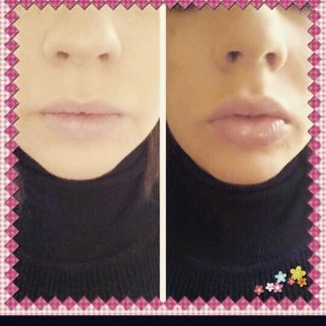 SteffBirch's tweet photo. Check out these amazing results... #Contouring/PlumpingLipGloss #DefinedCupidsBow #FullerLip #AmazingResults https://t.co/Vd4484tfea