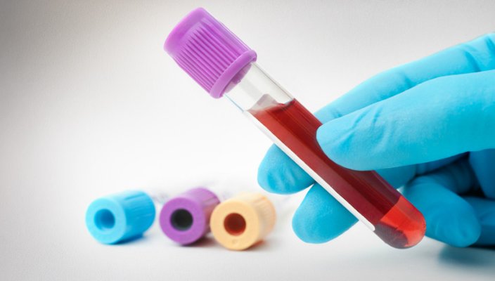 BMP: 8 #Blood Tests That Can Tell You Your State 
vitaminsdoc.com/basic-metaboli…