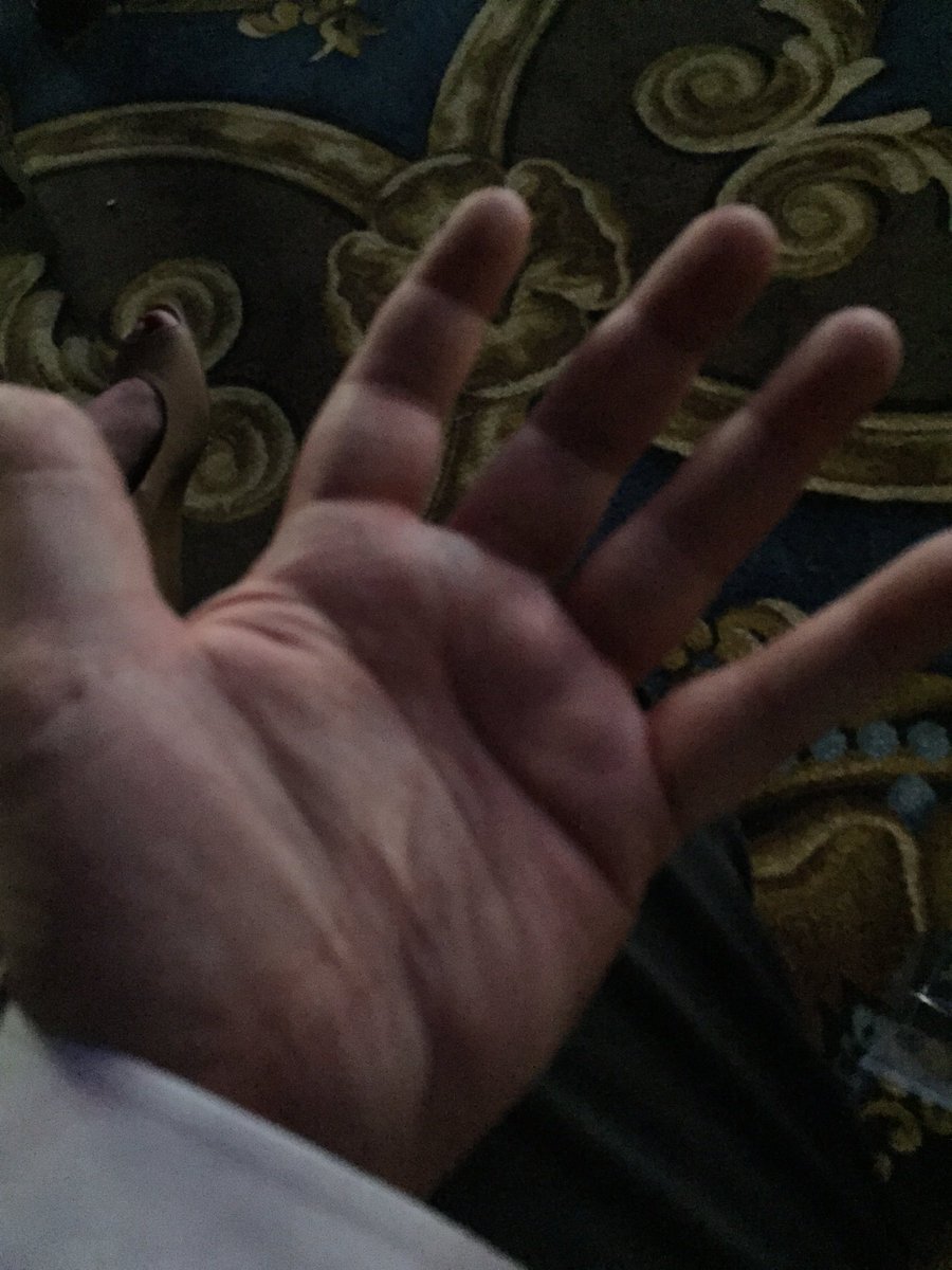 Hand print bacteria....ewwwwwwee #InfoComm16