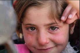 تبكي و لا تدري لـمن تشكي
لـو تبتسم حـيل مـكسورة  

عجزت من الـ آهه لا تحكي !
الحال بـانت من الصورة ..

#مشعل