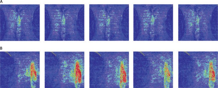 9/#366papers Measuring Female Sexual Arousal w/ Laser Doppler Imaging of Genital Blood Flow buff.ly/22NfRBc