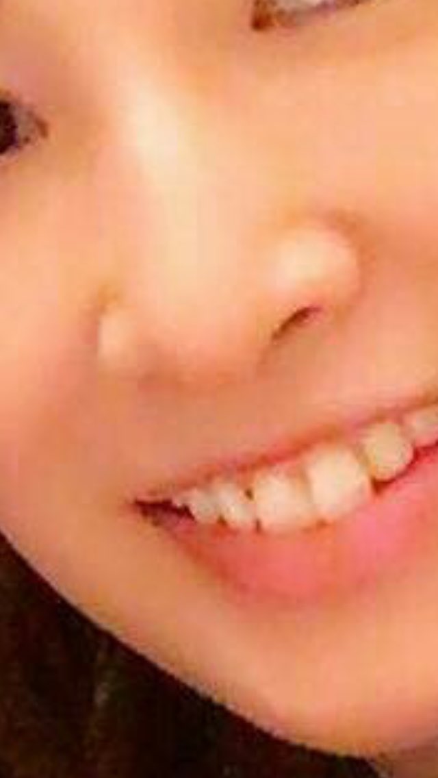 ショー 北川景子も歯に海苔刺さるんだなぁ ショー 北川景子も歯に海苔刺さるんだなぁ
