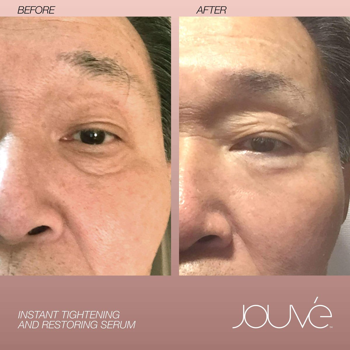 TezClark's tweet photo. https://t.co/V8c5COOi6W
#betterskin #removefinelines #lookthepart #lookyounger #nomorewrinkles #glow https://t.co/vFSOhFTJWv