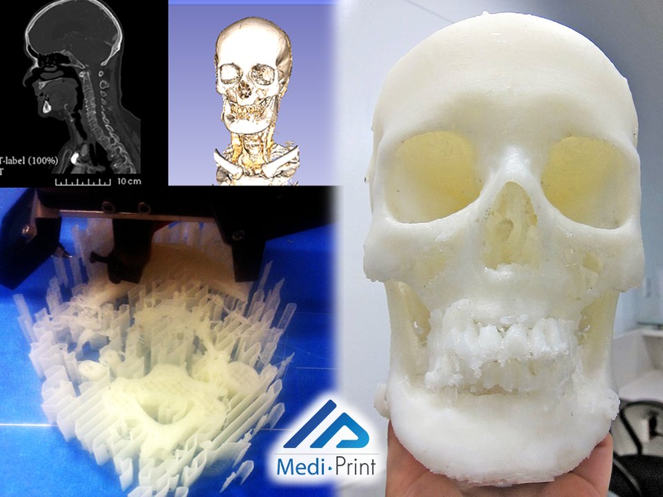 <a href="/MediPrint3D/">MediPrint</a> está de regreso en Twitter.
#impresion3D #craneo