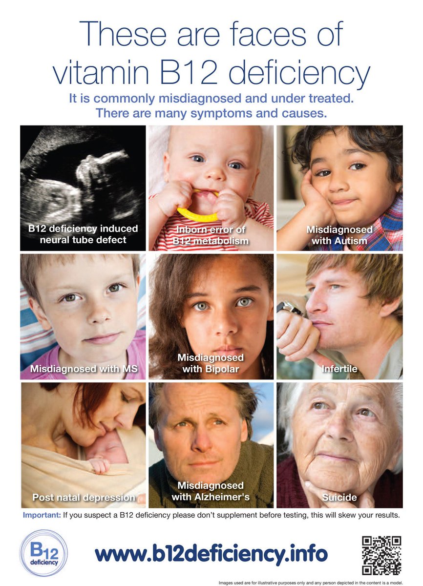 B12info's tweet photo. @RCObsGyn @BBCNews @EachBabyCounts and that's why midwives should be taught about B12 deficiency! #b12aware #matexp https://t.co/ew5uJZojxI