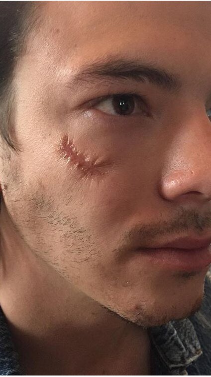 SandyJoJohnston's tweet photo. A simple scar from a music video I worked on #30daysofMakeUpLooks https://t.co/EC9HZpczOg