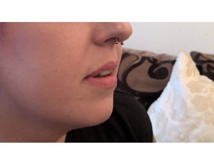 Elle_Aura_'s tweet photo. #lipjourney #dermalfillers #before #1ml #2mls #smooth and #flat to #volumised and #curvy 👄 #plump #pout #liplove 😍❤️ https://t.co/eGrIqquv5P