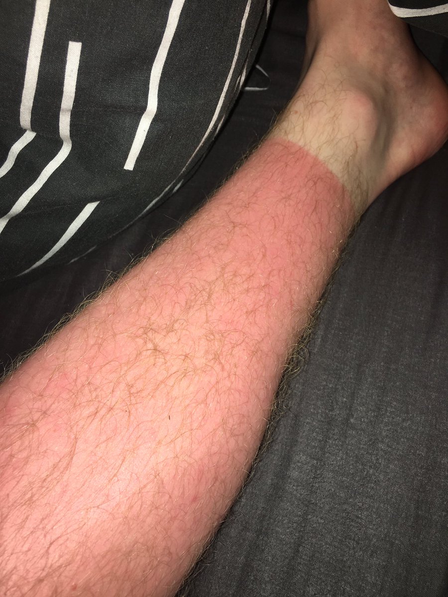 LukeBennett tweet media