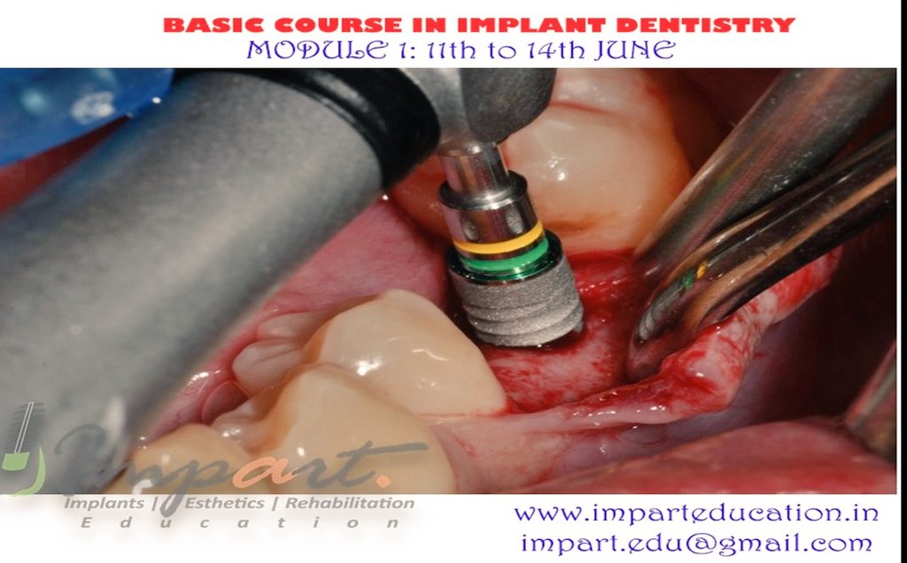 impart_edu's tweet photo. Basic course in Implantology # Batch 14 Module 1 , Day 1 # Full House # 16 Clinicians # 2 great mentors # https://t.co/3grtEM3tU4