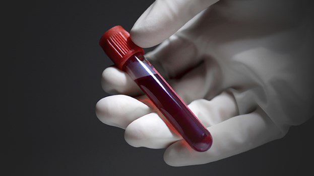 EverydayHealth's tweet photo. 10 things your doctor won't tell you about your blood tests: https://t.co/i0Rcbs8oRj https://t.co/7TRmbdRPSn