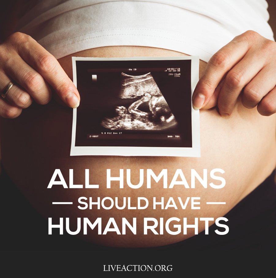 LiveAction's tweet photo. To be human is enough to grant the preborn a place of respect and protection in our society. #prolife https://t.co/TJ5IuWx0Dc