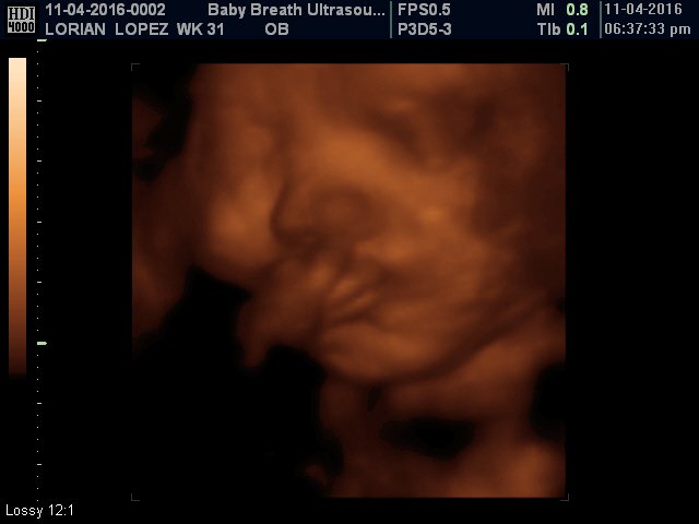 3d Baby Ultrasound breath1 Twitter 3d Baby Ultrasound breath1 Twitter