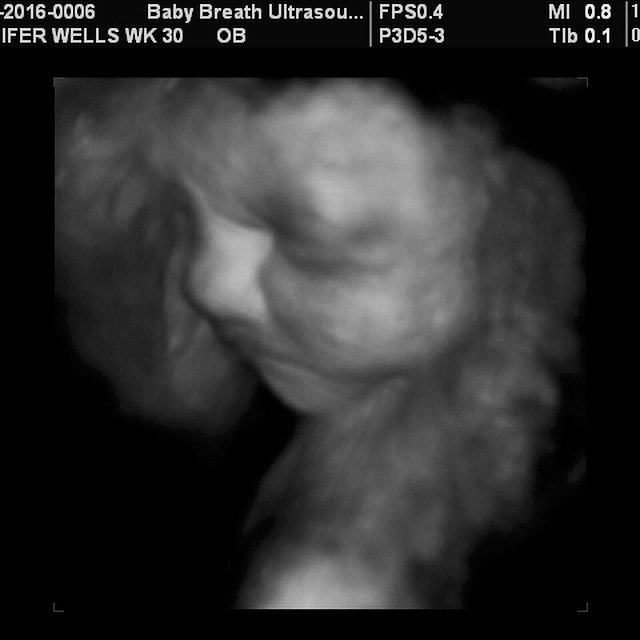 3d Baby Ultrasound breath1 Twitter 3d Baby Ultrasound breath1 Twitter