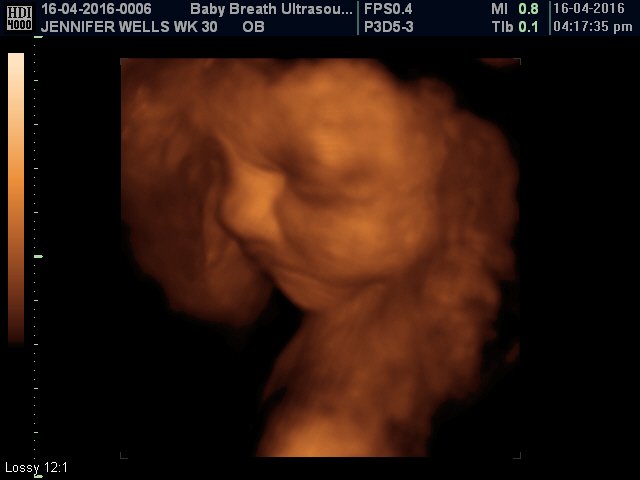 3d Baby Ultrasound breath1 Twitter 3d Baby Ultrasound breath1 Twitter