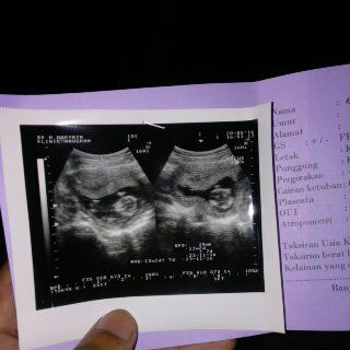 Selamat buat mas keyboardis yang sebentar lagi jadi ayah