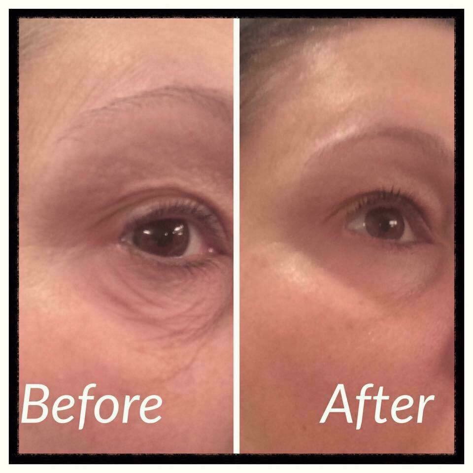 m_corvin's tweet photo. Yet another amazing result of our Multifunction Eye Cream! 
You decide the difference!
Rodan + Fields https://t.co/5ySBJc5rNA