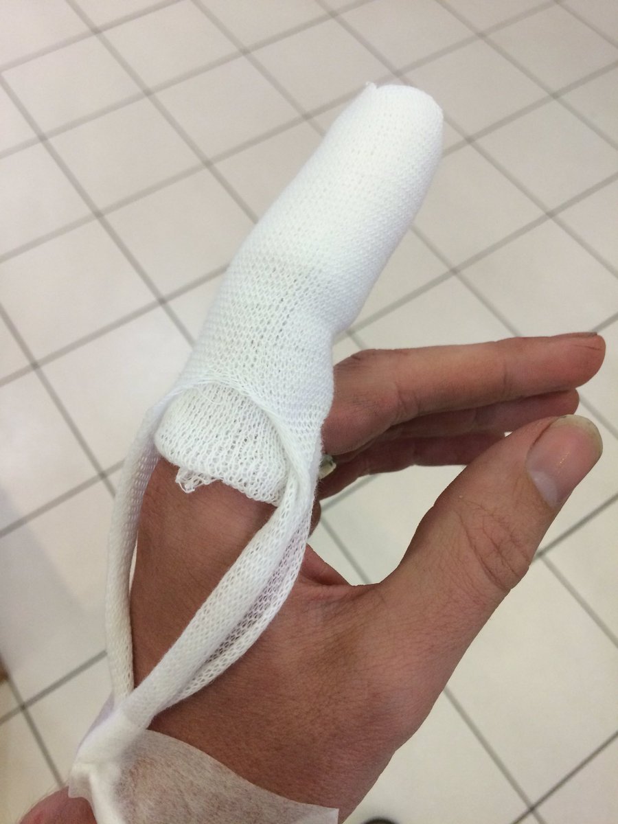 MrHoggsClass's tweet photo. Good start to summer. #knivesaresharp #stitches #hatethatsong #angryhogg https://t.co/84vR7dctPG