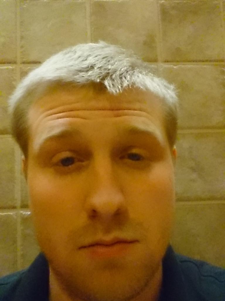 Wikeee2007's tweet photo. My left eye has thrown in the towel #nosleep https://t.co/aGpVlx89Xj