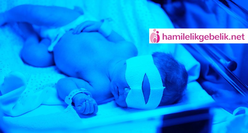 ozelcumlecikler's tweet image. Bebeklerde Sarılık
bit.ly/2963YSZ