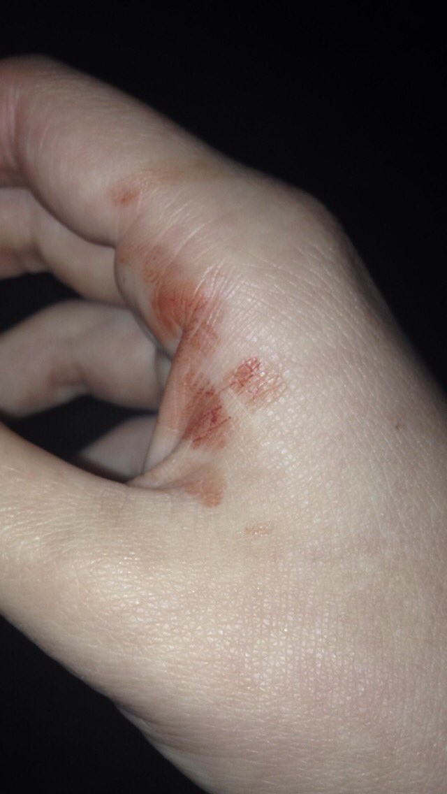 quitleybleeding tweet picture