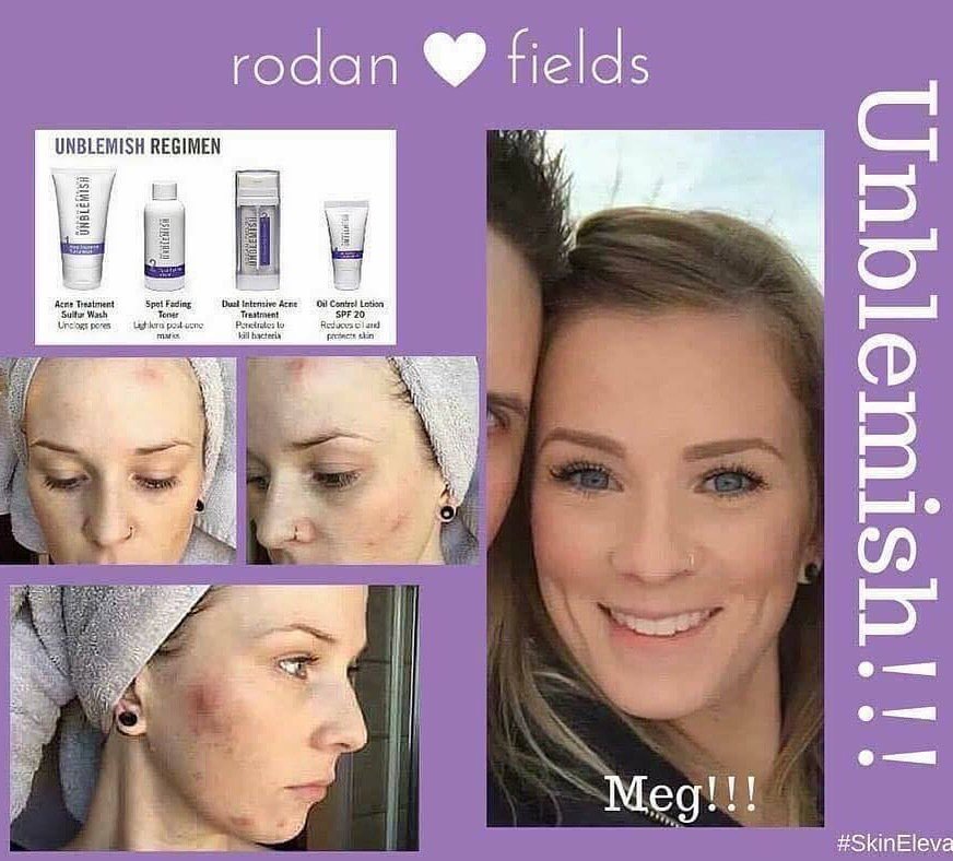 kellymgoss's tweet photo. There's still time 2 enter!!--#Giveaway Rodan and Fields $117 UNBLEMISH https://t.co/NOskkwyZT1… https://t.co/UdUKEh8aXJ