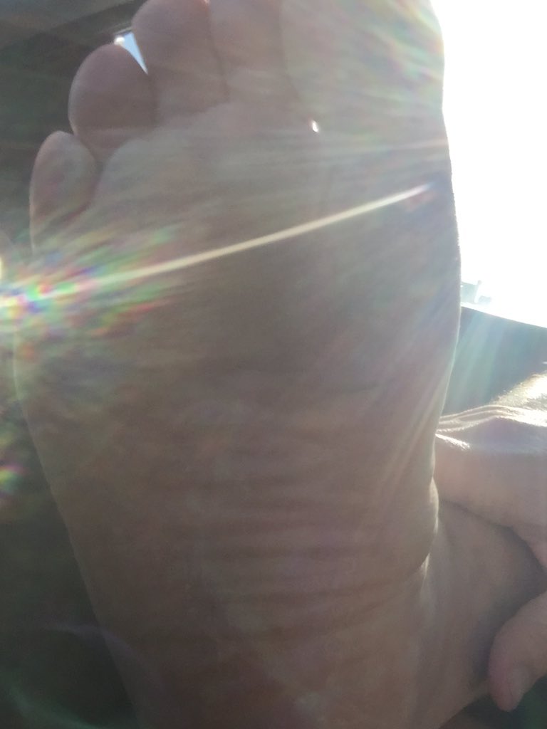 WhoDeyDaddy's tweet photo. @bkforrester thanks brother! Thanks for going back out with me too! #TotalFootBlister #UltraMarathonProblems https://t.co/dZbdrEfaBw