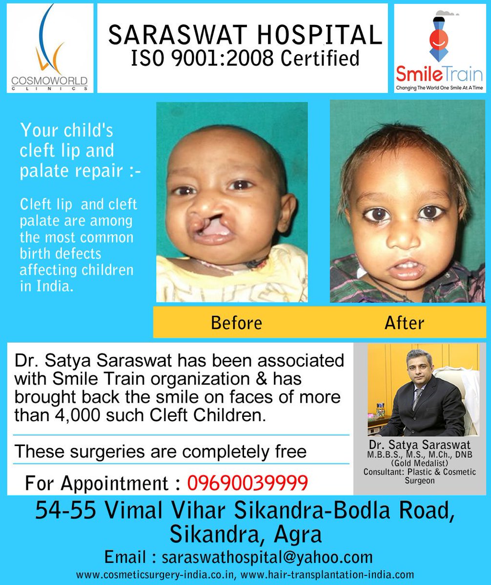 DrSatyaSaraswat's tweet photo. #CleftLipAndPalate #BioFUE #HairTransplantIndia #CosmoworldClinic #SaraswatHospital https://t.co/cm2aiOfTkr