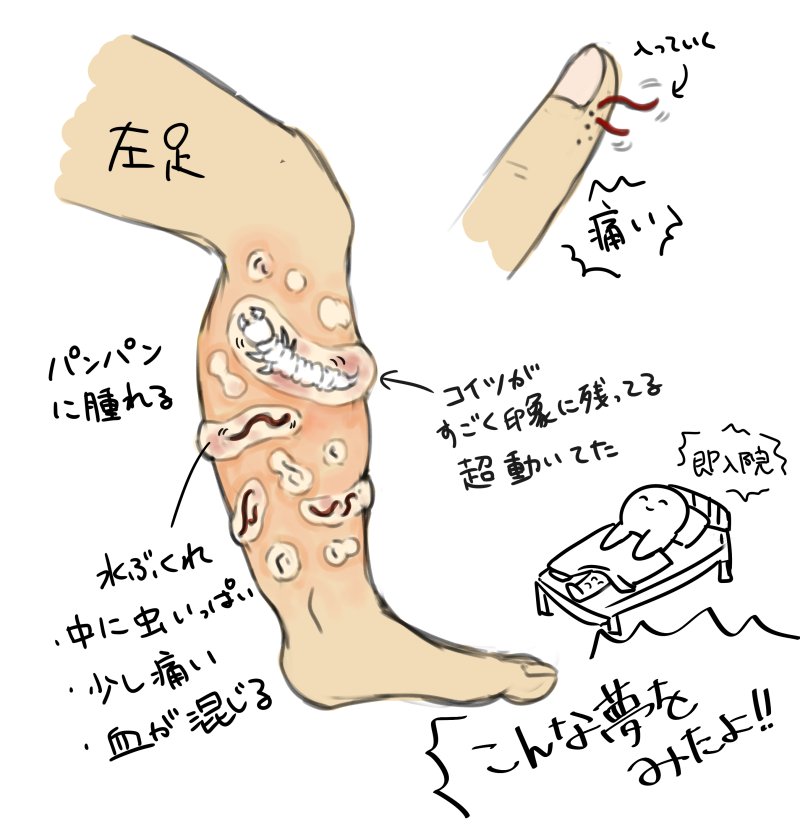 ちょっとグロ注意??昨日みた夢。文字にするよりもわかりやすいと思って描いてみた('◉◞౪◟◉`)こんなんなっても入院と聞いた瞬間、命どうこうよりも仕事がやばい!と思ってしまったよね・・・ 