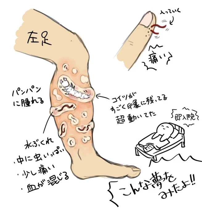 ちょっとグロ注意??昨日みた夢。文字にするよりもわかりやすいと思って描いてみた('◉◞౪◟◉`)こんなんなっても入院と聞いた瞬間、命どうこうよりも仕事がやばい!と思ってしまったよね・・・ 