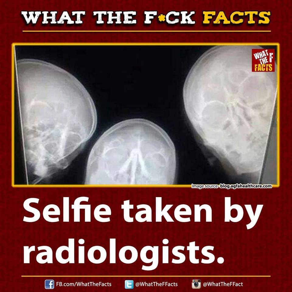 WhatTheFFacts's tweet photo. https://t.co/CMlMQE62dZ